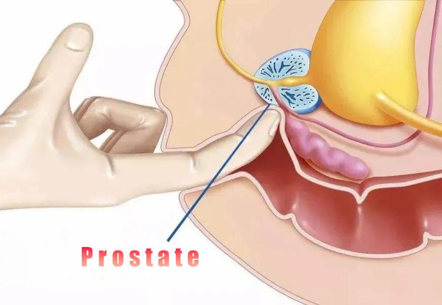 Prostate Health and Men's Another Kind of Orgasm